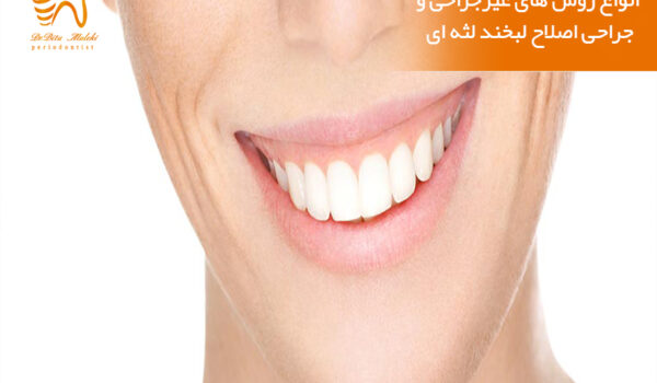 اصلاح لبخند