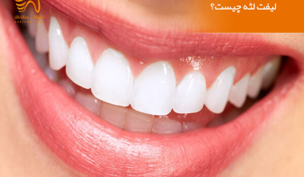 لیفت لثه چیست؟